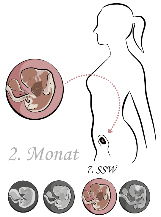 7. SSW - 7. Schwangerschaftswoche: Ultraschall Bauch Fehlgeburt 